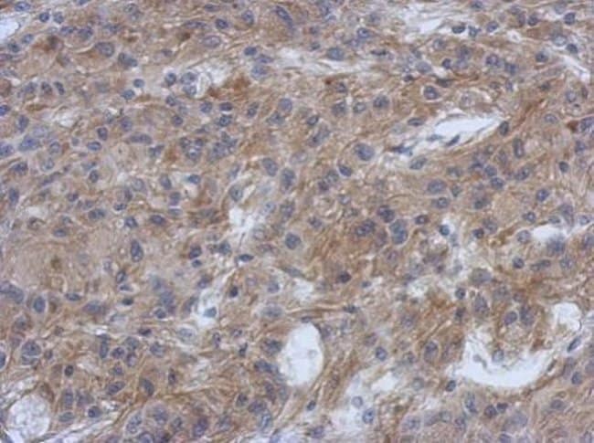 100uL Polyclonal antibody, PPFIBP1, host