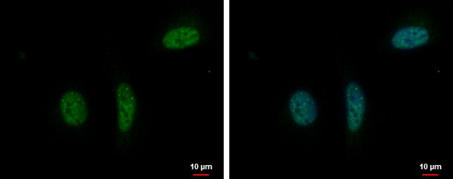 100uL Polyclonal antibody, RPRD1B, host