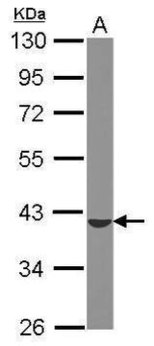 100uL Polyclonal antibody, ST6GALNAC4, h
