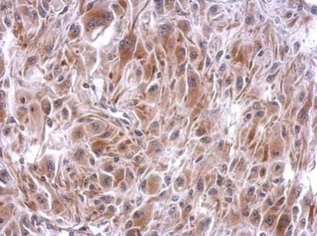 100uL Polyclonal antibody, SLFNL1, host