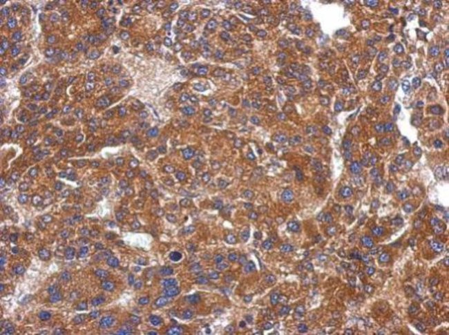 100uL Polyclonal antibody, FLJ30058, hos