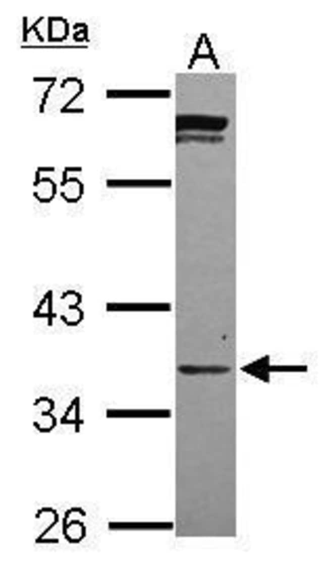 100uL Polyclonal antibody, PPCS, host ra