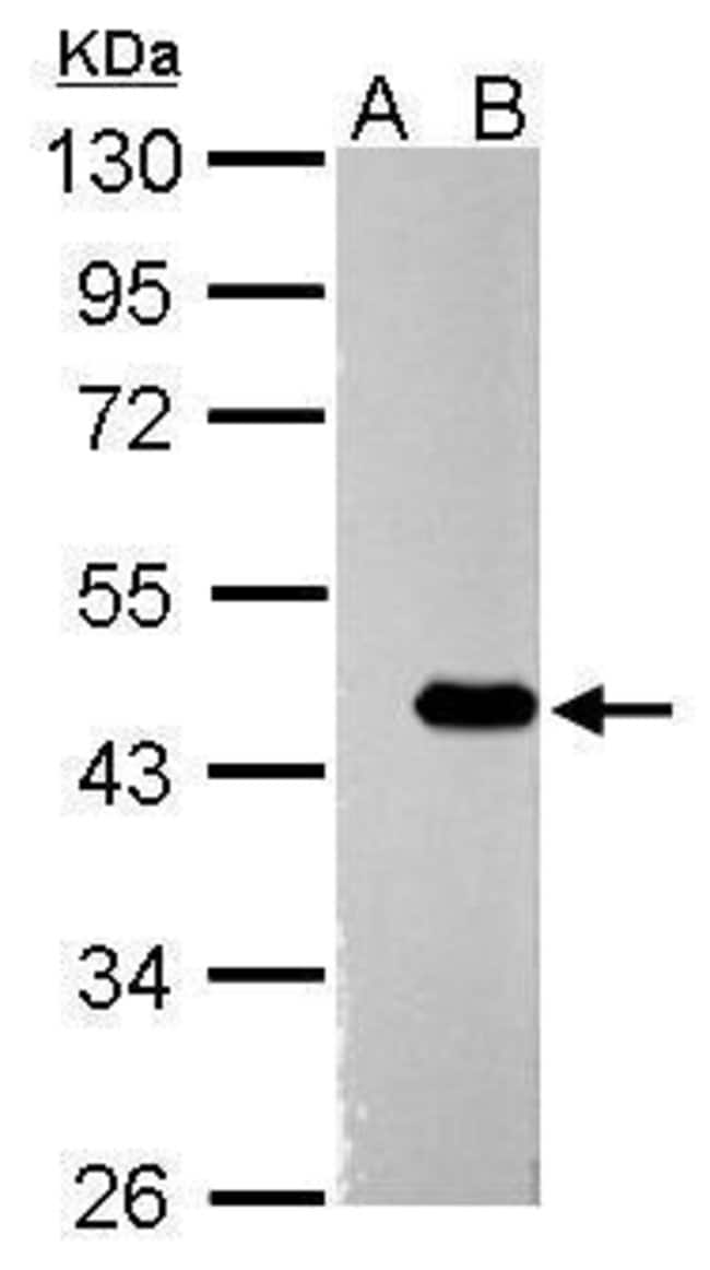 100uL Polyclonal antibody, ZBTB24, host