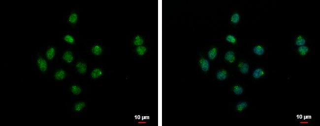 100uL Polyclonal antibody, SYAP1, host r