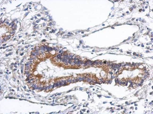 100uL Polyclonal antibody, PODN, host ra
