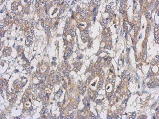 100uL Polyclonal antibody, UXS1, host ra