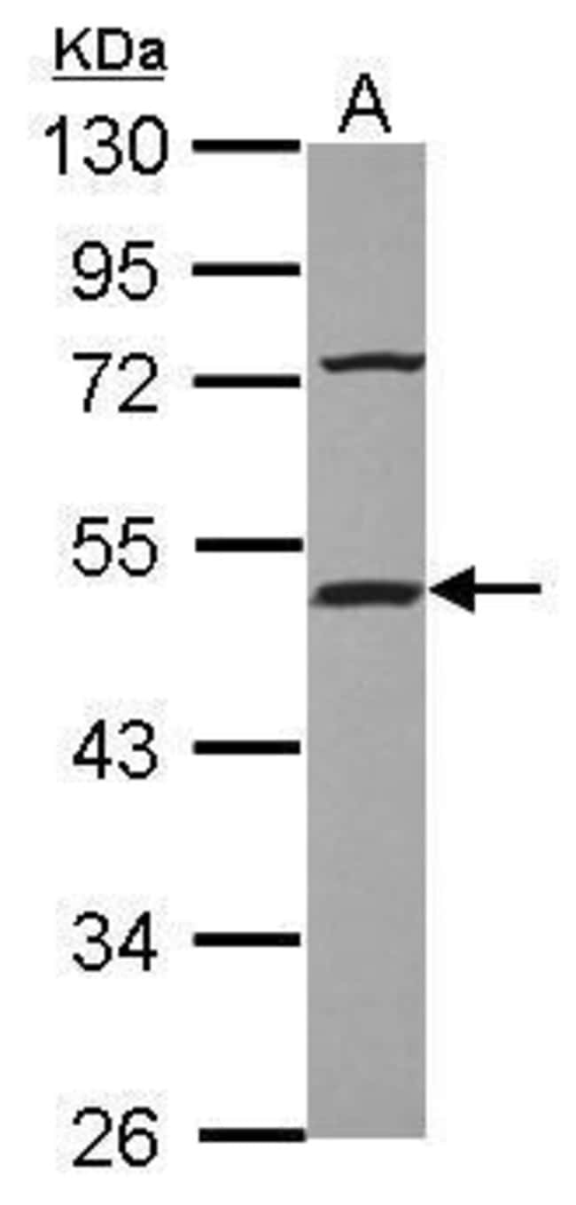 100uL Polyclonal antibody, HIP, host rab