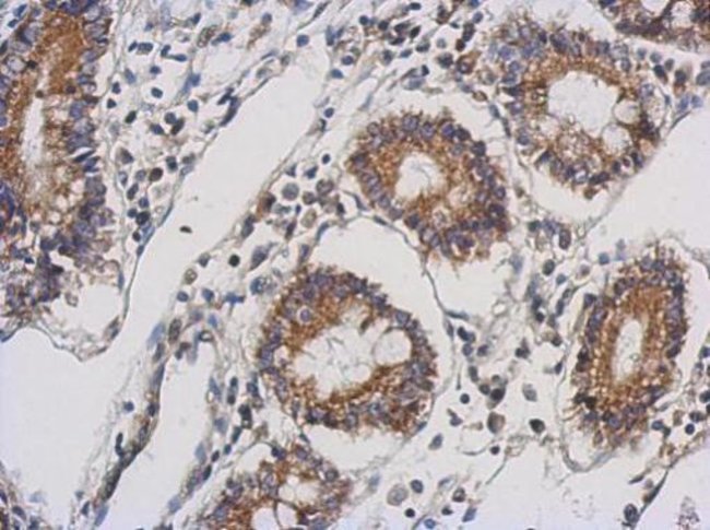 100uL Polyclonal antibody, TTLL10, host