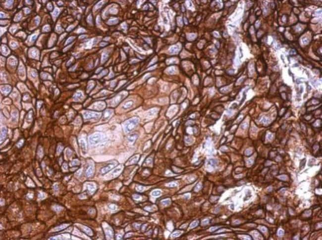 100uL Polyclonal antibody, KLHDC5, host