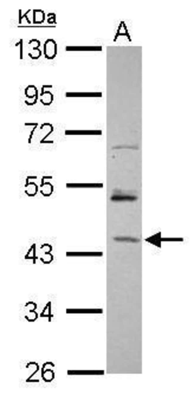 100uL Polyclonal antibody, RBM17, host r