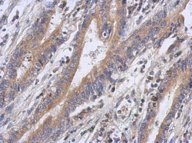100uL Polyclonal antibody, FBXW5, host r