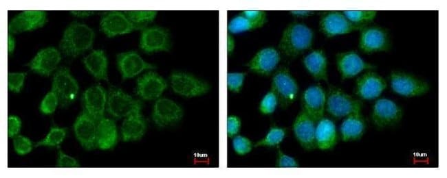 100uL Polyclonal antibody, ALS2CR12, hos