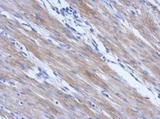 100uL Polyclonal antibody, CCDC17, host