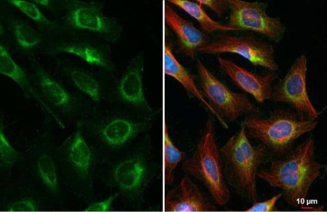 100uL Polyclonal antibody, CKAP4, host r