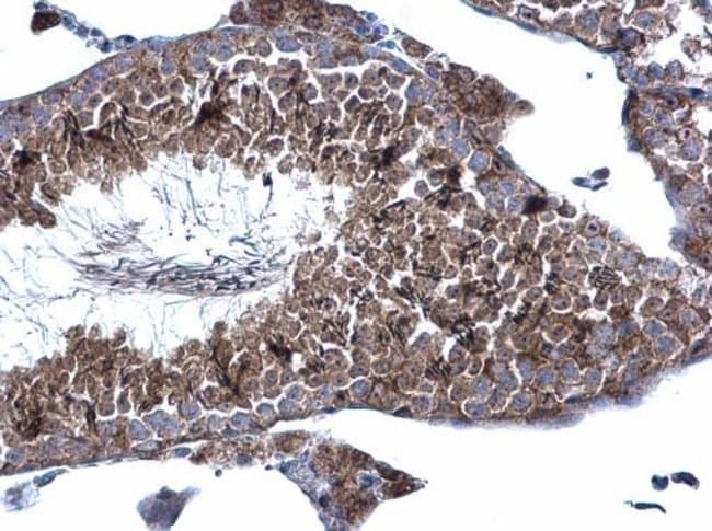 100uL Polyclonal antibody, KATNAL1, host