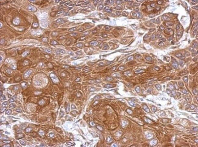 100uL Polyclonal antibody, THOC5, host r