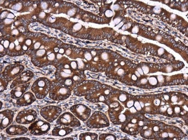 100uL Polyclonal antibody, DYNC1LI1, hos