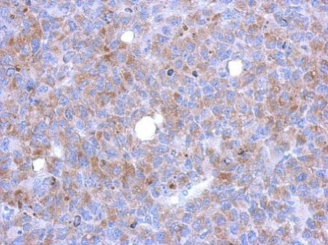 100uL Polyclonal antibody, DDEFL1, host