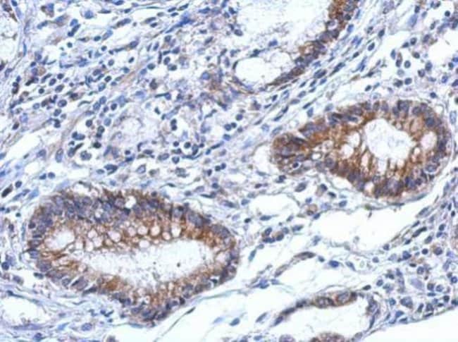 100uL Polyclonal antibody, TARS2, host r