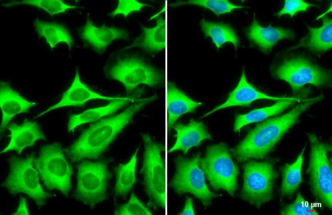 100uL Polyclonal antibody, ZC3HAV1, host