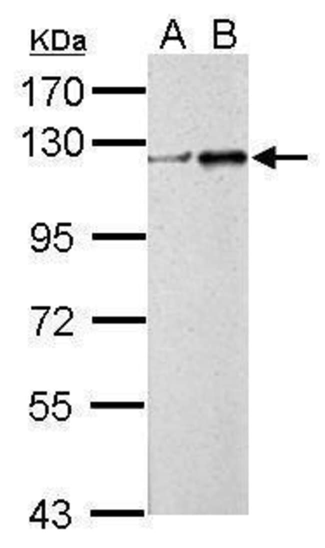 100uL Polyclonal antibody, ZNF711, host