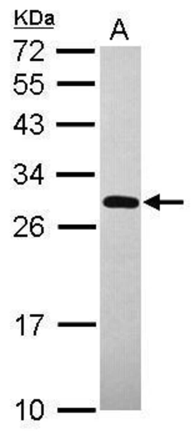 100uL Polyclonal antibody, UNKL, host ra