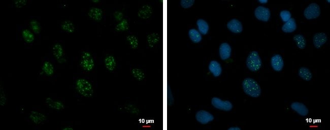 100uL Polyclonal antibody, NPD014, host