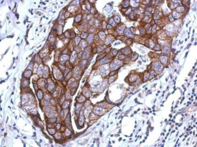100uL Polyclonal antibody, WDR65, host r