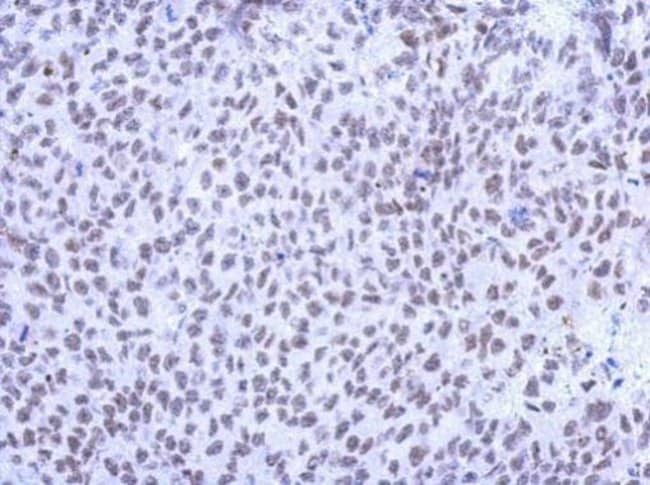 100uL Polyclonal antibody, KLHL13, host