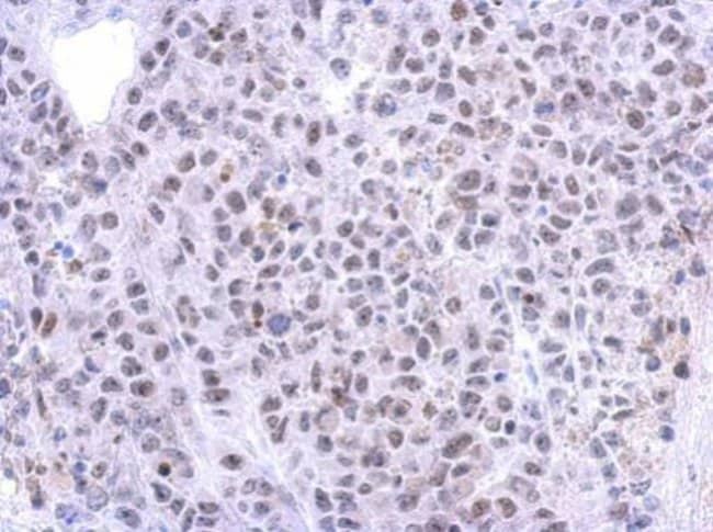 100uL Polyclonal antibody, RRP12, host r