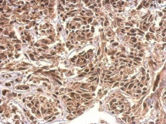 100uL Polyclonal antibody, KIAA0323, hos