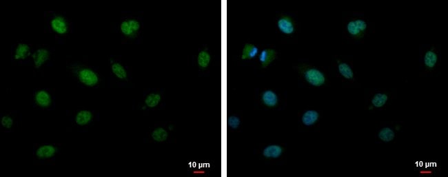 100uL Polyclonal antibody, CIRBP, host r