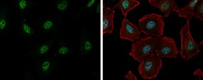 100uL Polyclonal antibody, RBM26, host r