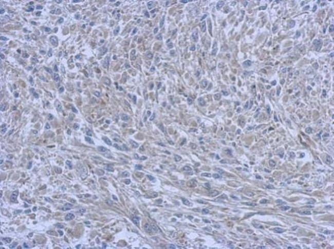 100uL Polyclonal antibody, FCHO1, host r