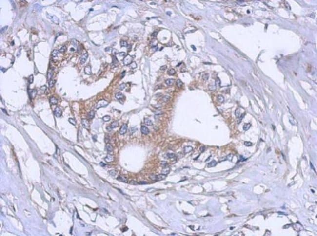 100uL Polyclonal antibody, RPL12, host r