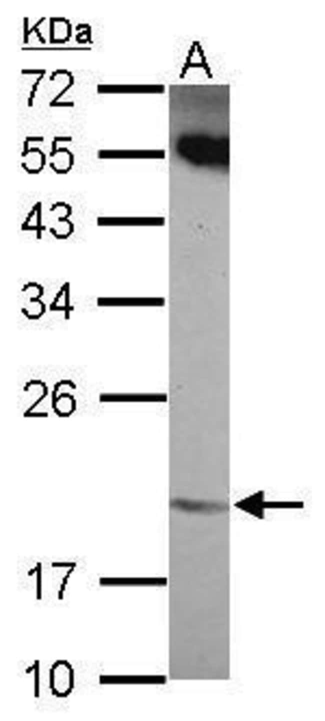 100uL Polyclonal antibody, ANKRD39, host