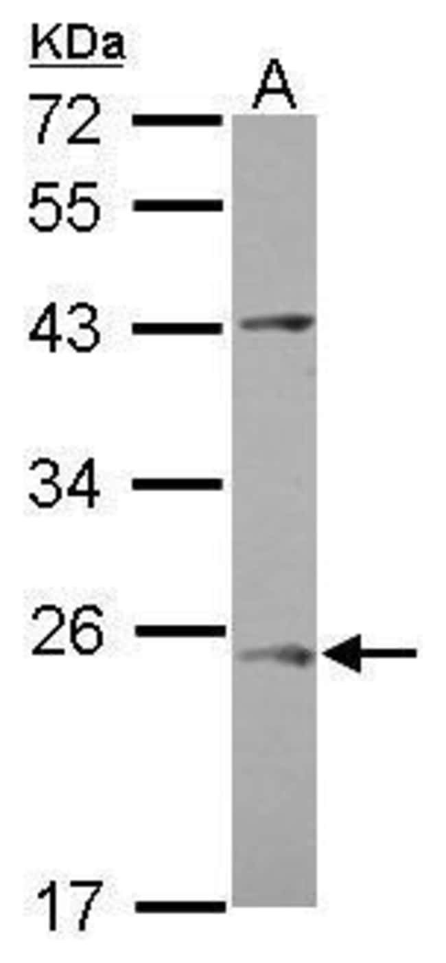 100uL Polyclonal antibody, C1orf146, hos