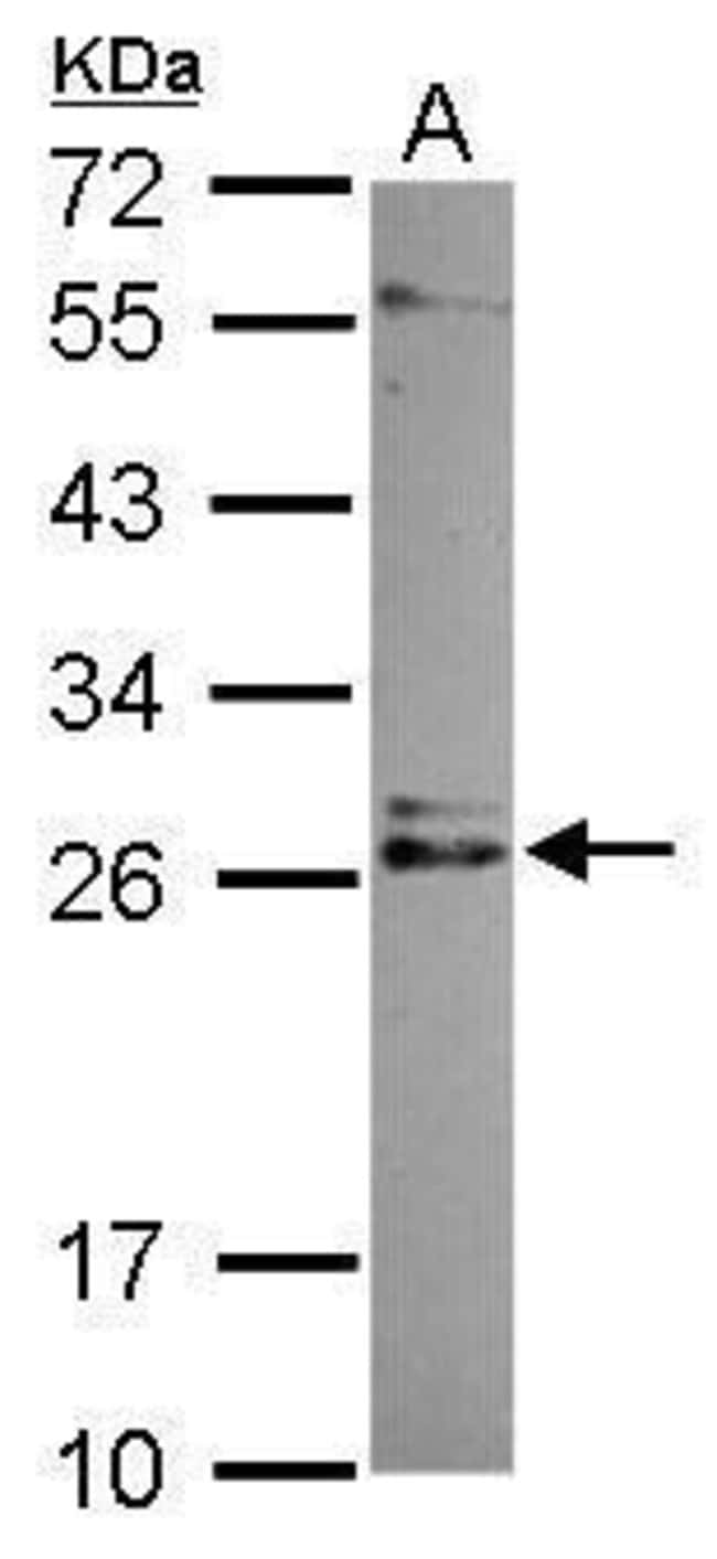 100uL Polyclonal antibody, IMP3, host ra