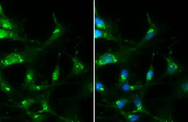 100uL Polyclonal antibody, RAB35, host r