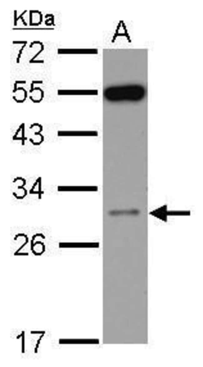 100uL Polyclonal antibody, RPS8, host ra