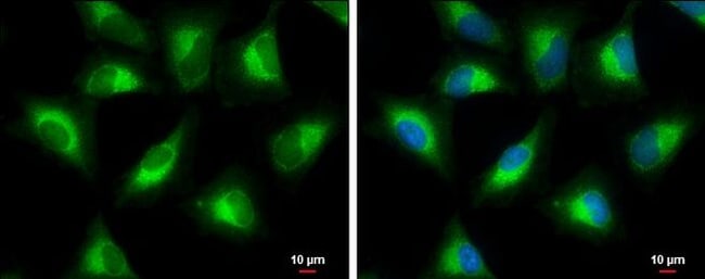 100uL Polyclonal antibody, PGLS, host ra