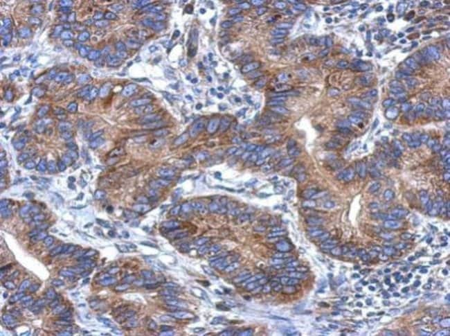 100uL Polyclonal antibody, CCDC70, host