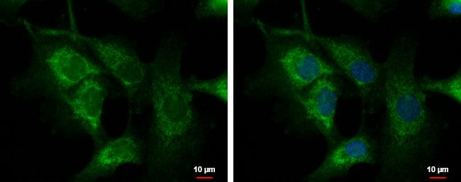 100uL Polyclonal antibody, C1orf74, host