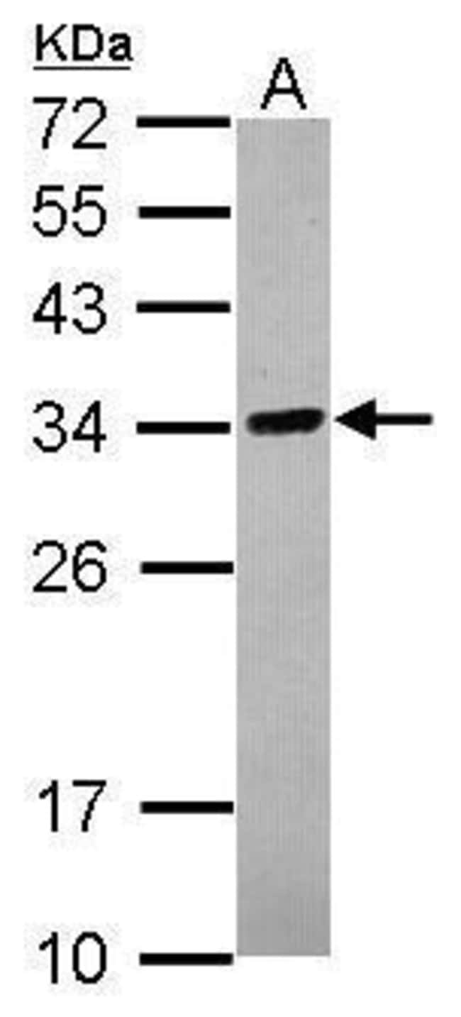100uL Polyclonal antibody, C18orf10, hos