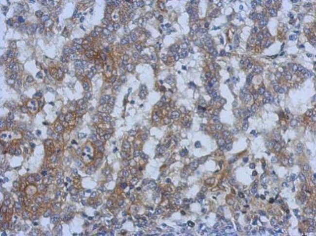 100uL Polyclonal antibody, SPRYD5, host