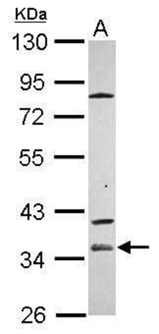 100uL Polyclonal antibody, ZP1, host rab