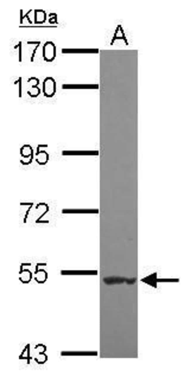 100uL Polyclonal antibody, NARG1L, host