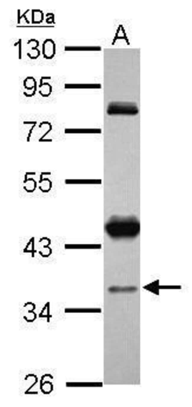 100uL Polyclonal antibody, CCDC94, host
