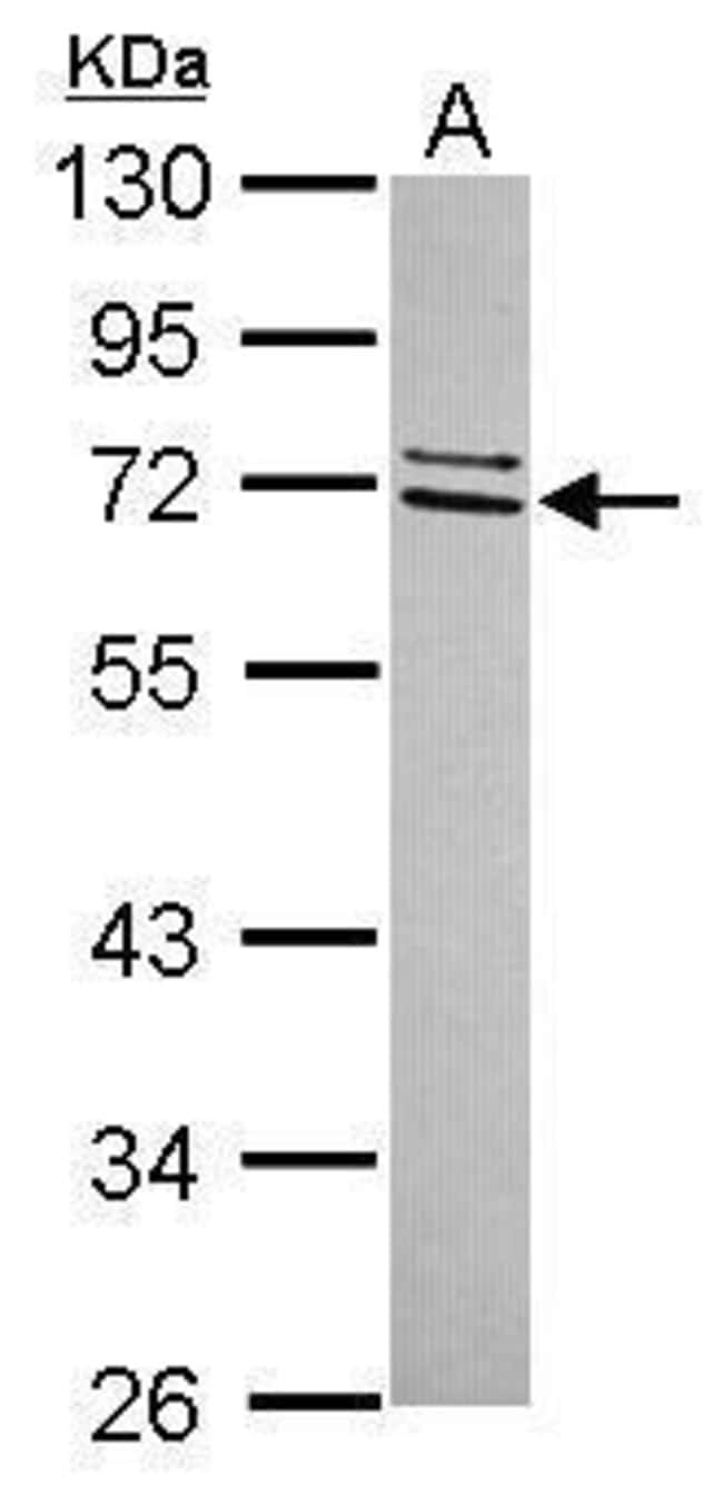 100uL Polyclonal antibody, CCDC67, host
