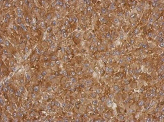 100uL Polyclonal antibody, ACTRT1, host